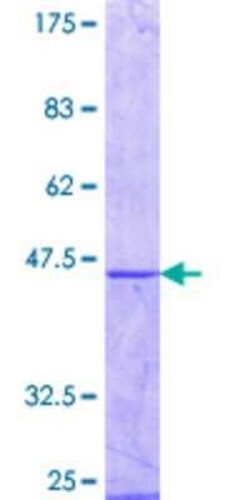 Novus Biologicals Recombinant Human MAGEB1 GST (N-Term) Protein 10 &mu;g | Buy Online | Novus Biologicals&trade; | Fisher Scientific