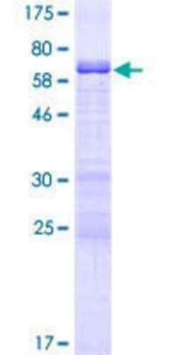 Novus Biologicals Recombinant Human MAGEB4 GST (N-Term) Protein 10 &mu;g | Buy Online | Novus Biologicals&trade; | Fisher Scientific
