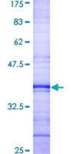 Novus Biologicals Recombinant Human MAK GST (N-Term) Protein 10 &mu;g | Buy Online | Novus Biologicals&trade; | Fisher Scientific