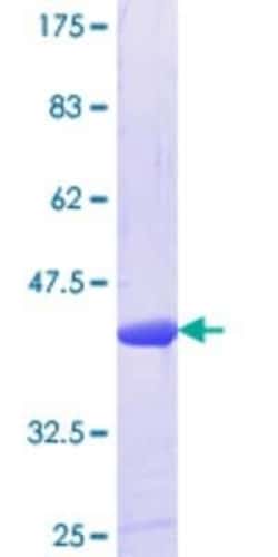 Novus Biologicals Recombinant Human alpha 1 Mannosidase 1A GST (N-Term) Protein 25 &mu;g | Buy Online | Novus Biologicals&trade; | Fisher Scientific