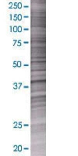 Novus Biologicals alpha 1 Mannosidase 1A 293T Cell Transient Overexpression Lysate 0.1 mL | Buy Online | Novus Biologicals&trade; | Fisher Scientific