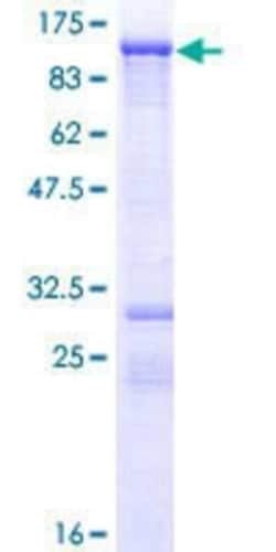 Novus Biologicals Recombinant Human Mark3 GST (N-Term) Protein 25 &mu;g | Buy Online | Novus Biologicals&trade; | Fisher Scientific
