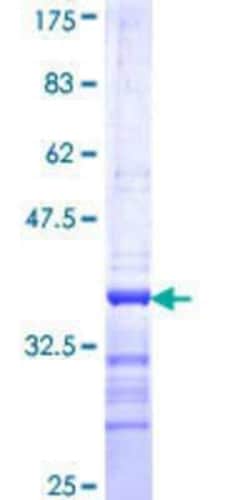 Novus Biologicals Recombinant Human MATK GST (N-Term) Protein 25 &mu;g | Buy Online | Novus Biologicals&trade; | Fisher Scientific