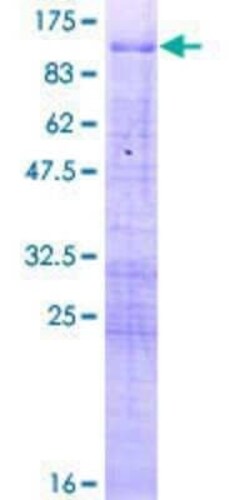 Novus Biologicals Recombinant Human MBD1 GST (N-Term) Protein 2 &mu;g | Buy Online | Novus Biologicals&trade; | Fisher Scientific