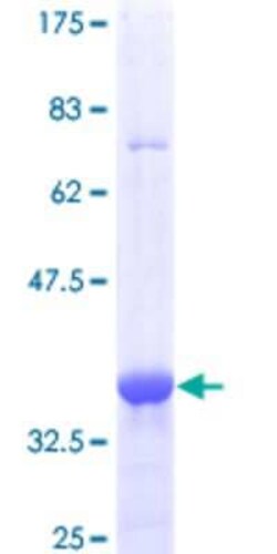 Novus Biologicals Recombinant Human MBD1 GST (N-Term) Protein 25 &mu;g | Buy Online | Novus Biologicals&trade; | Fisher Scientific