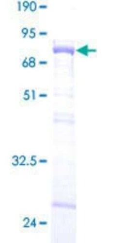 Novus Biologicals Recombinant Human Muscleblind-like 1 GST (N-Term) Protein 25 &mu;g | Buy Online | Novus Biologicals&trade; | Fisher Scientific