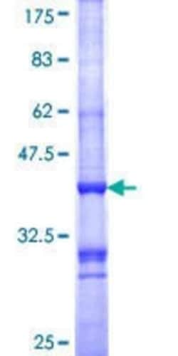 Novus Biologicals Recombinant Human Melanocortin-1 R/MC1R GST (N-Term) Protein 25 &mu;g | Buy Online | Novus Biologicals&trade; | Fisher Scientific
