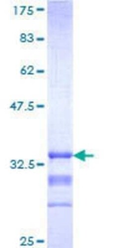 Novus Biologicals Recombinant Human Melanocortin-3 R/MC3R GST (N-Term) Protein 25 &mu;g | Buy Online | Novus Biologicals&trade; | Fisher Scientific
