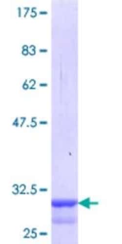 Novus Biologicals Recombinant Human Melanocortin-4 R GST (N-Term) Protein 10 &mu;g | Buy Online | Novus Biologicals&trade; | Fisher Scientific