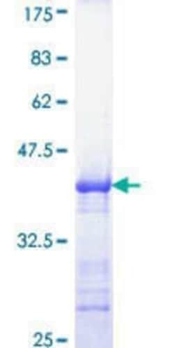 Novus Biologicals Recombinant Human MCC GST (N-Term) Protein 10 &mu;g | Buy Online | Novus Biologicals&trade; | Fisher Scientific