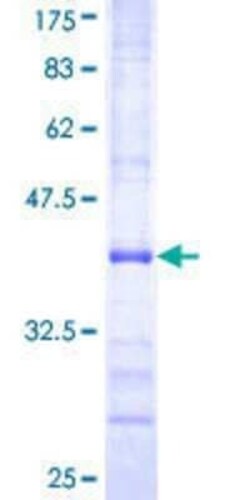 Novus Biologicals Recombinant Human MCM2 GST (N-Term) Protein 25 &mu;g | Buy Online | Novus Biologicals&trade; | Fisher Scientific