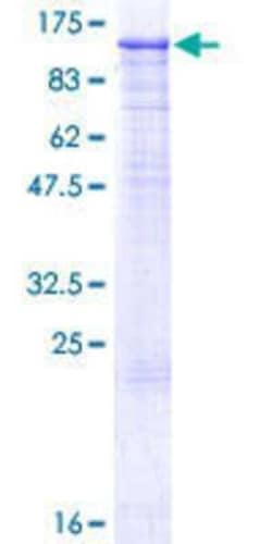 Novus Biologicals Recombinant Human MCM4 GST (N-Term) Protein 25 &mu;g | Buy Online | Novus Biologicals&trade; | Fisher Scientific
