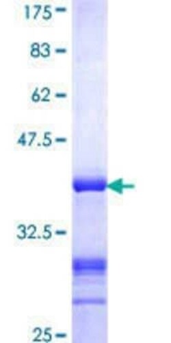Novus Biologicals Recombinant Human MCM4 GST (N-Term) Protein 10 &mu;g | Buy Online | Novus Biologicals&trade; | Fisher Scientific