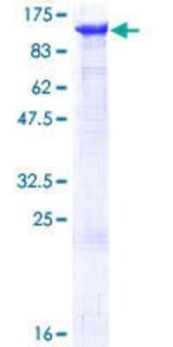 Novus Biologicals Recombinant Human MCM6 GST (N-Term) Protein 25 &mu;g | Buy Online | Novus Biologicals&trade; | Fisher Scientific