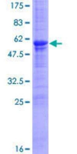 Novus Biologicals Recombinant Human MDFI GST (N-Term) Protein 25 &mu;g | Buy Online | Novus Biologicals&trade; | Fisher Scientific