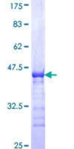 Novus Biologicals Recombinant Human MDFI GST (N-Term) Protein 25 &mu;g | Buy Online | Novus Biologicals&trade; | Fisher Scientific