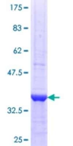 Novus Biologicals Recombinant Human MDG1 GST (N-Term) Protein 10 &mu;g | Buy Online | Novus Biologicals&trade; | Fisher Scientific
