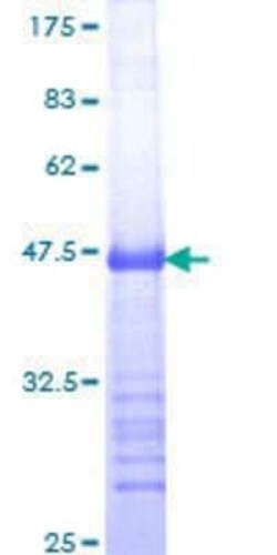 Novus Biologicals Recombinant Human MDMX GST (N-Term) Protein 25 &mu;g | Buy Online | Novus Biologicals&trade; | Fisher Scientific