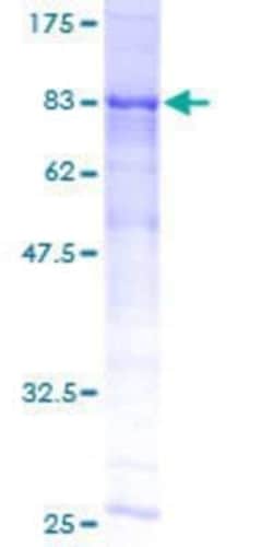 Novus Biologicals Recombinant Human ME1 GST (N-Term) Protein 10 &mu;g | Buy Online | Novus Biologicals&trade; | Fisher Scientific