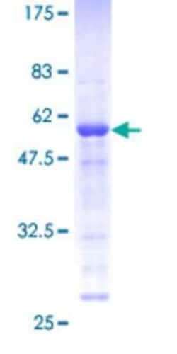 Novus Biologicals Recombinant Human MEA-1 GST (N-Term) Protein 25 &mu;g | Buy Online | Novus Biologicals&trade; | Fisher Scientific