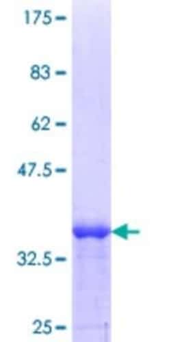 Novus Biologicals Recombinant Human MEA-1 GST (N-Term) Protein 25 &mu;g | Buy Online | Novus Biologicals&trade; | Fisher Scientific