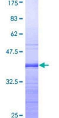 Novus Biologicals Recombinant Human MeCP2 GST (N-Term) Protein 10 &mu;g | Buy Online | Novus Biologicals&trade; | Fisher Scientific