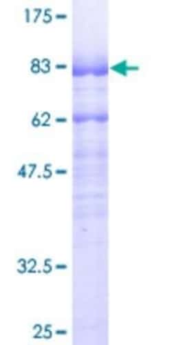 Novus Biologicals Recombinant Human MEF2A GST (N-Term) Protein 10 &mu;g | Buy Online | Novus Biologicals&trade; | Fisher Scientific