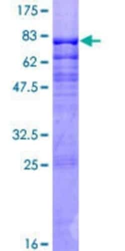 Novus Biologicals™ Recombinant Human MEF2C GST (N-Term) Protein