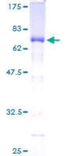 Novus Biologicals Recombinant Human MEIS2 GST (N-Term) Protein 10 &mu;g | Buy Online | Novus Biologicals&trade; | Fisher Scientific