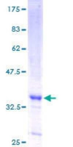 Novus Biologicals Recombinant Human MEKK3 GST (N-Term) Protein 25 &mu;g | Buy Online | Novus Biologicals&trade; | Fisher Scientific