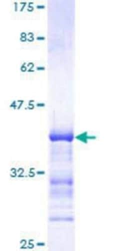 Novus Biologicals Recombinant Human MEKK4 GST (N-Term) Protein 10 &mu;g | Buy Online | Novus Biologicals&trade; | Fisher Scientific