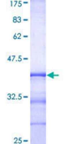 Novus Biologicals&trade;&nbsp;Recombinant Human RAB8A GST (N-Term) Protein