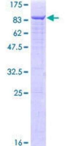 Novus Biologicals Recombinant Human Menin GST (N-Term) Protein 10 &mu;g | Buy Online | Novus Biologicals&trade; | Fisher Scientific