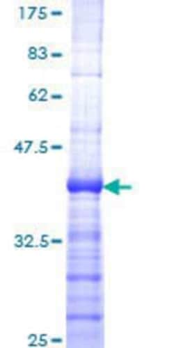 Novus Biologicals Recombinant Human Menin GST (N-Term) Protein 25 &mu;g | Buy Online | Novus Biologicals&trade; | Fisher Scientific