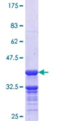 Novus Biologicals Recombinant Human MOX1 GST (N-Term) Protein 10 &mu;g | Buy Online | Novus Biologicals&trade; | Fisher Scientific