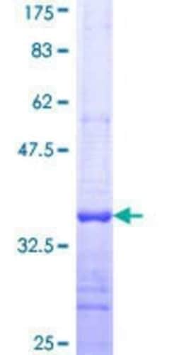 Novus Biologicals Recombinant Human MFNG GST (N-Term) Protein 10 &mu;g | Buy Online | Novus Biologicals&trade; | Fisher Scientific