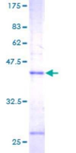 Novus Biologicals Recombinant Human Microsomal Glutathione S-transferase 1 GST (N-Term) Protein 25 &mu;g | Buy Online | Novus Biologicals&trade; | Fisher Scientific