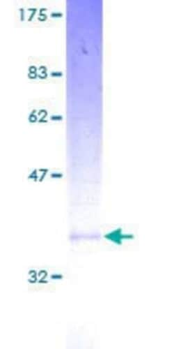 Novus Biologicals Recombinant Human MGST3 GST (N-Term) Protein 2 &mu;g | Buy Online | Novus Biologicals&trade; | Fisher Scientific