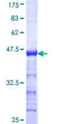 Novus Biologicals Recombinant Human CIITA GST (N-Term) Protein 25 &mu;g | Buy Online | Novus Biologicals&trade; | Fisher Scientific