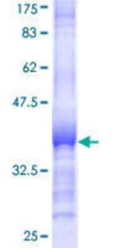 Novus Biologicals Recombinant Human MID1 GST (N-Term) Protein 10 &mu;g | Buy Online | Novus Biologicals&trade; | Fisher Scientific