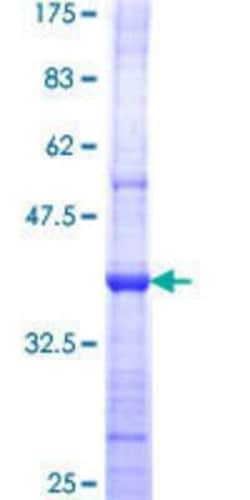 Novus Biologicals Recombinant Human MIPEP GST (N-Term) Protein 25 &mu;g | Buy Online | Novus Biologicals&trade; | Fisher Scientific