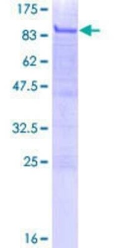 Novus Biologicals Recombinant Human MITF GST (N-Term) Protein 2 &mu;g | Buy Online | Novus Biologicals&trade; | Fisher Scientific