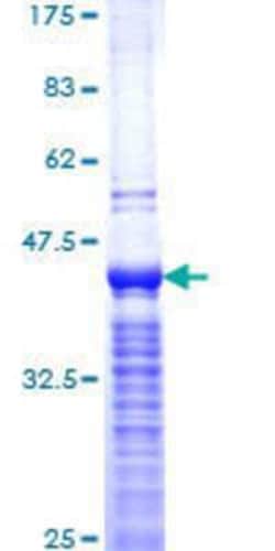 Novus Biologicals Recombinant Human Ki67/MKI67 GST (N-Term) Protein 10 &mu;g | Buy Online | Novus Biologicals&trade; | Fisher Scientific