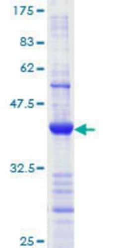 Novus Biologicals Recombinant Human MLH1 GST (N-Term) Protein 25 &mu;g | Buy Online | Novus Biologicals&trade; | Fisher Scientific