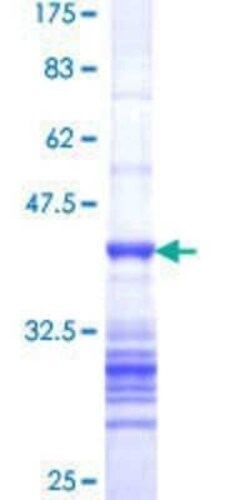 Novus Biologicals Recombinant Human mLK2 GST (N-Term) Protein 25 &mu;g | Buy Online | Novus Biologicals&trade; | Fisher Scientific