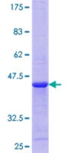 Novus Biologicals Recombinant Human Motilin GST (N-Term) Protein 25 &mu;g | Buy Online | Novus Biologicals&trade; | Fisher Scientific