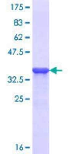 Novus Biologicals Recombinant Human AF4 GST (N-Term) Protein 10 &mu;g | Buy Online | Novus Biologicals&trade; | Fisher Scientific
