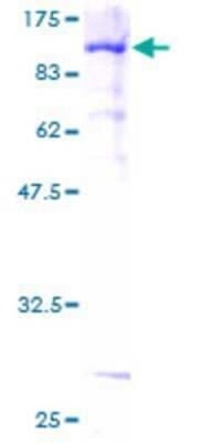Novus Biologicals Recombinant Human AF9 GST (N-Term) Protein 2 &mu;g | Buy Online | Novus Biologicals&trade; | Fisher Scientific