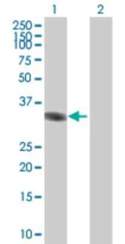 Novus Biologicals&trade;&nbsp;MLLT6 293T Cell Transient Overexpression Lysate