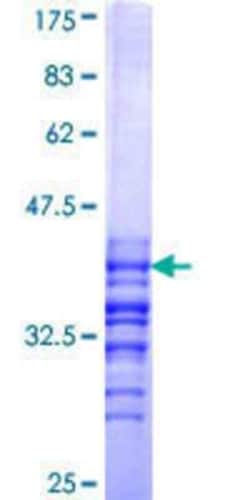 Novus Biologicals Recombinant Human MN1 GST (N-Term) Protein 25 &mu;g | Buy Online | Novus Biologicals&trade; | Fisher Scientific
